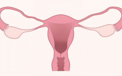 Sterilizzazione femminile Bergamo e provincia